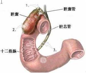  福州哪个医院看十二指肠炎不错