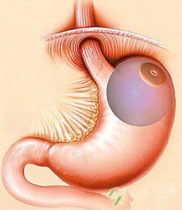福州看胃息肉哪家医院好